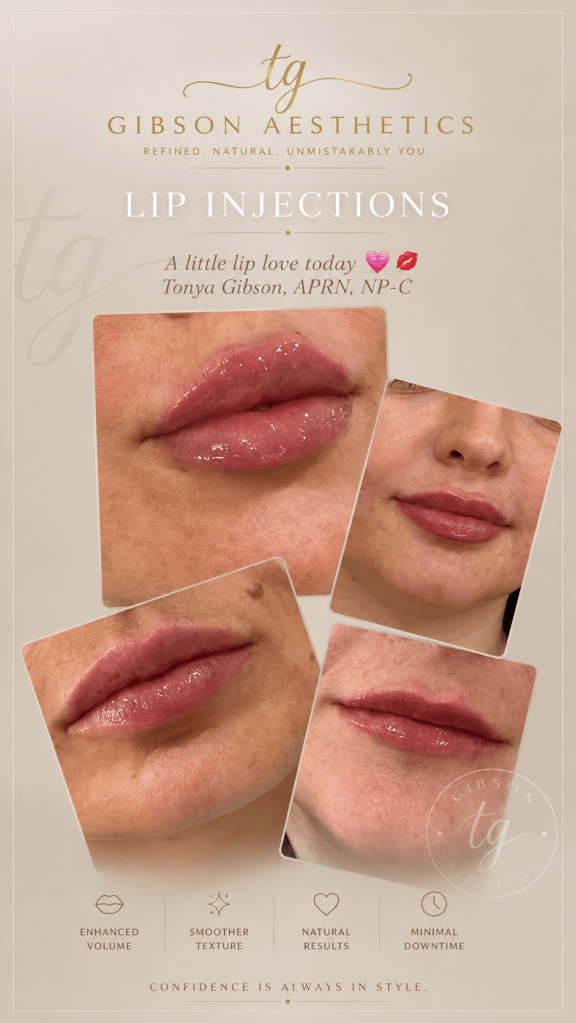 Lip injections - a little lip love before and after