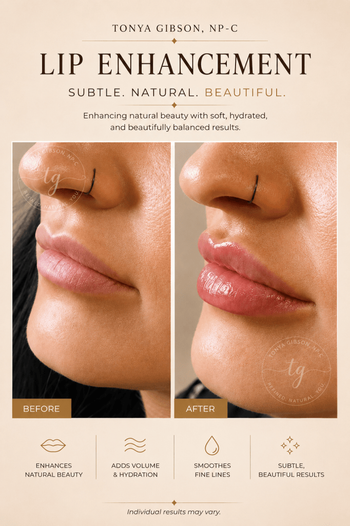 Lip enhancement before and after - added volume and natural results
