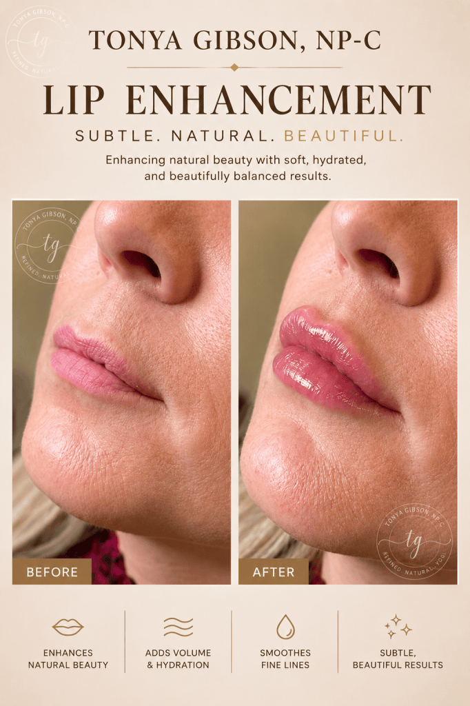 Lip enhancement before and after - subtle beautiful results