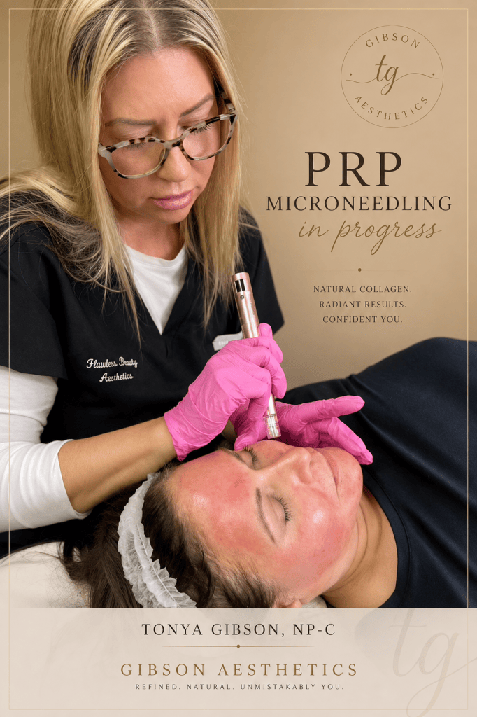 PRP Microneedling in progress