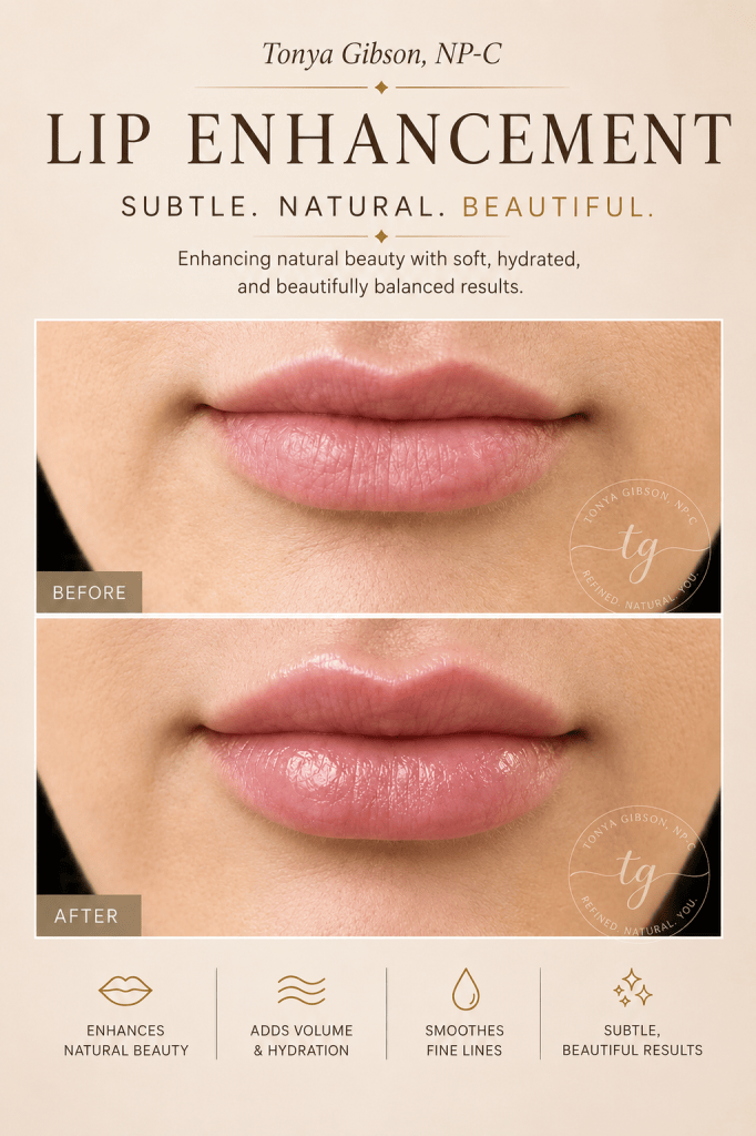 Lip enhancement before and after - subtle natural results