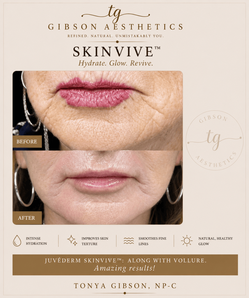 Skinvive before and after - Juvederm Skinvive with Vollure results