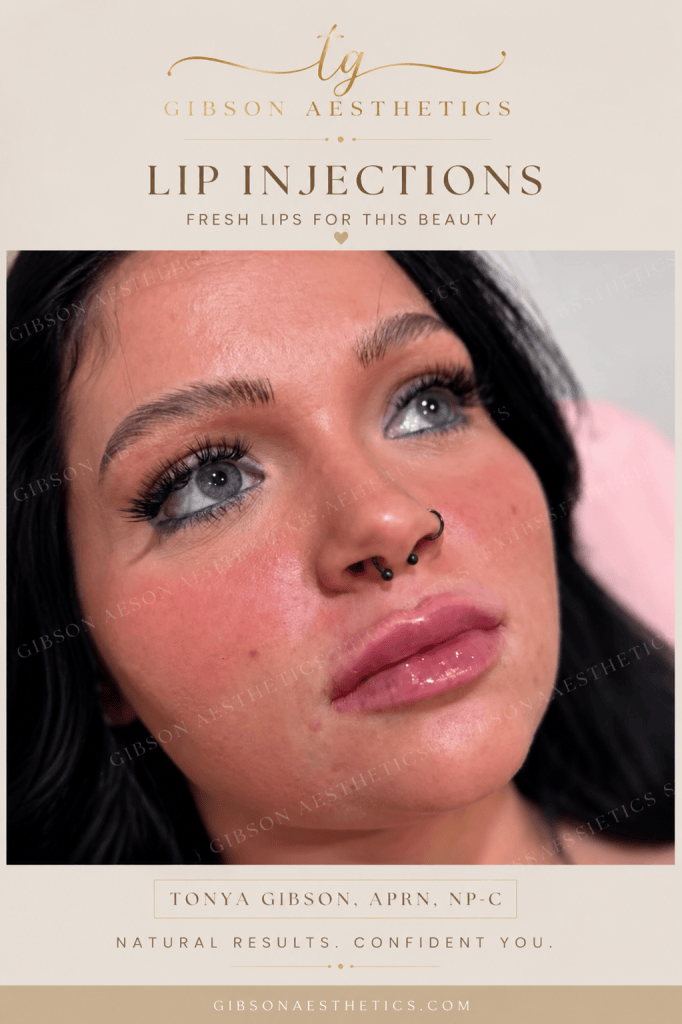 Lip injections - fresh lips natural results